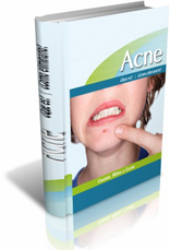 acne - box - saludfisicaymental.com